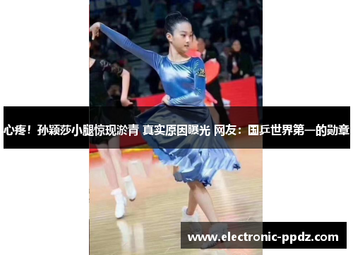 心疼！孙颖莎小腿惊现淤青 真实原因曝光 网友：国乒世界第一的勋章
